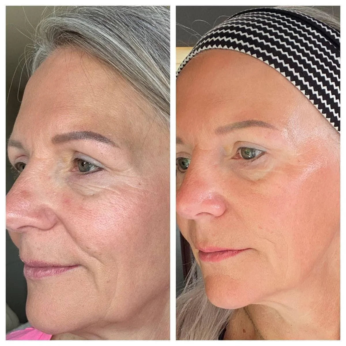 Soma Aura LED Face Pro Rejuvenation Mask